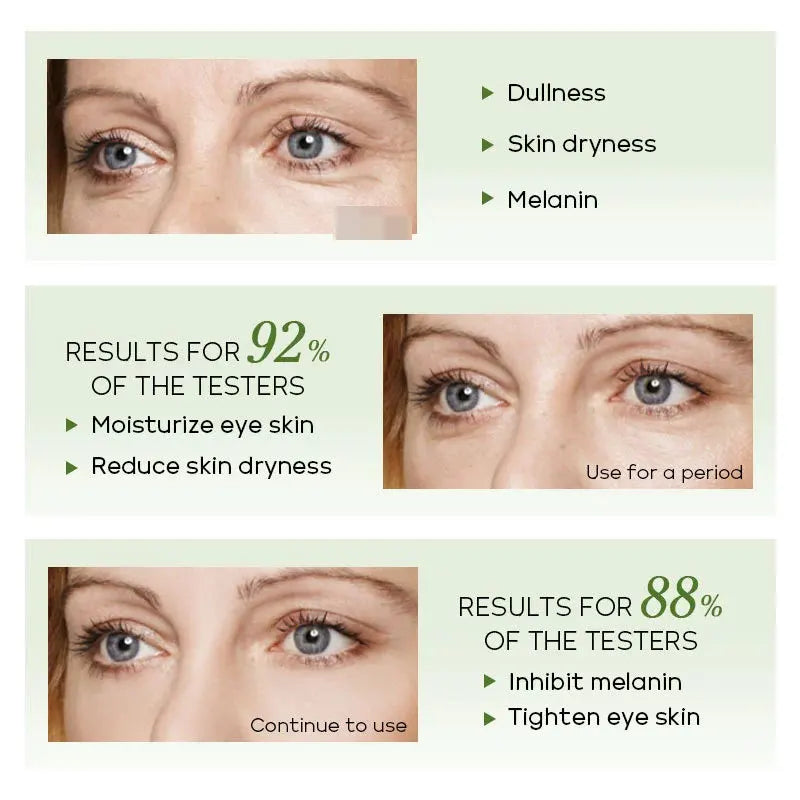 15Ml Anti-Aging Green Tea Eye Serum anti Dark Circles Eye Bags Anti-Wrinkles Moisturizing Skincare Eyes Serum Skin Care for Eyes